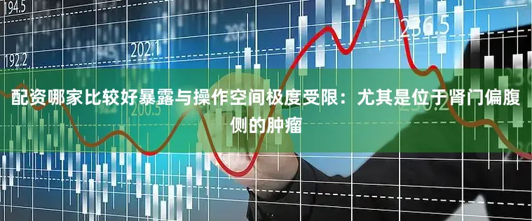 配资哪家比较好暴露与操作空间极度受限：尤其是位于肾门偏腹侧的肿瘤